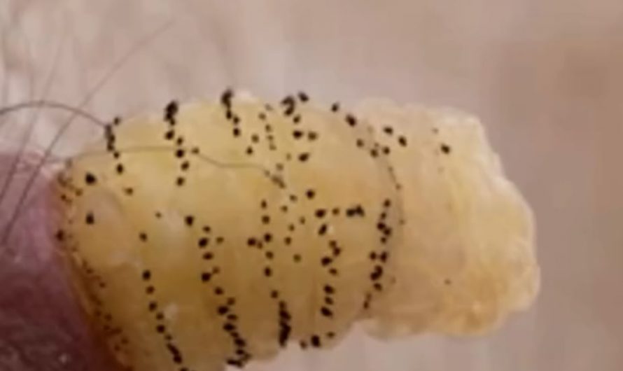 A scientist decides to let the botflies that got into his skin, reach maturity and document the events