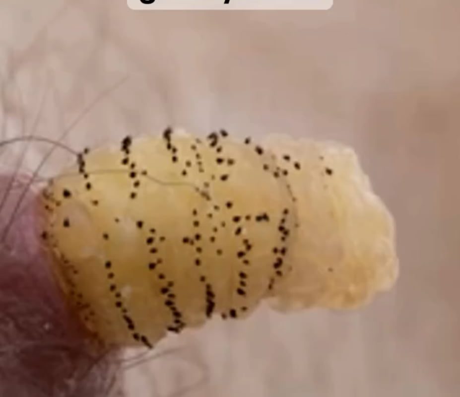 A scientist decides to let the botflies that got into his skin, reach maturity and document the events