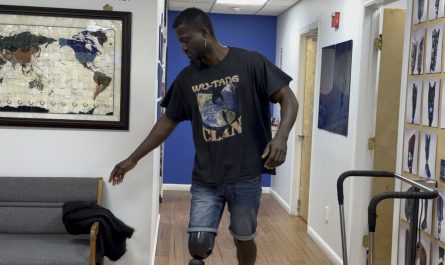 An amputee walking with a very technological improved prosthetic.