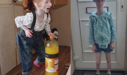 Charlotte Garside, the girl with primordial dwarfism who was said would never grow over 2 feet is now 4 feet tall