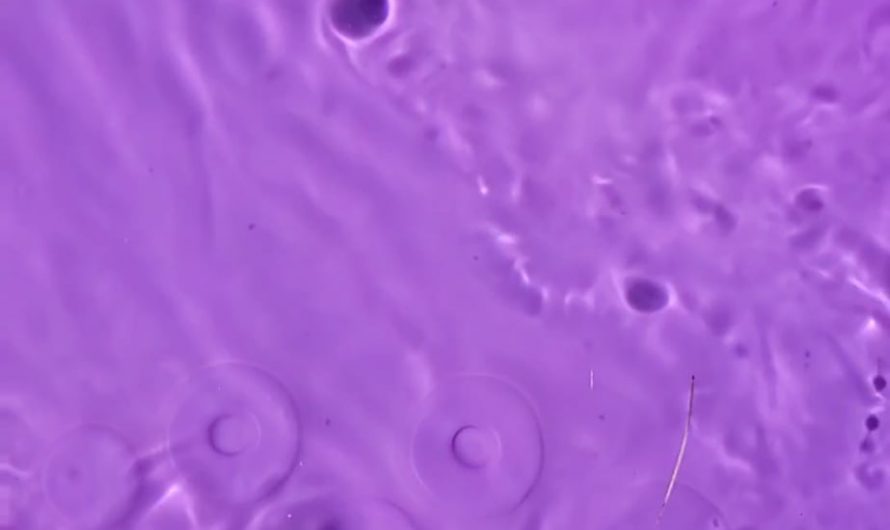 Endless vortex shadows while filling my pool