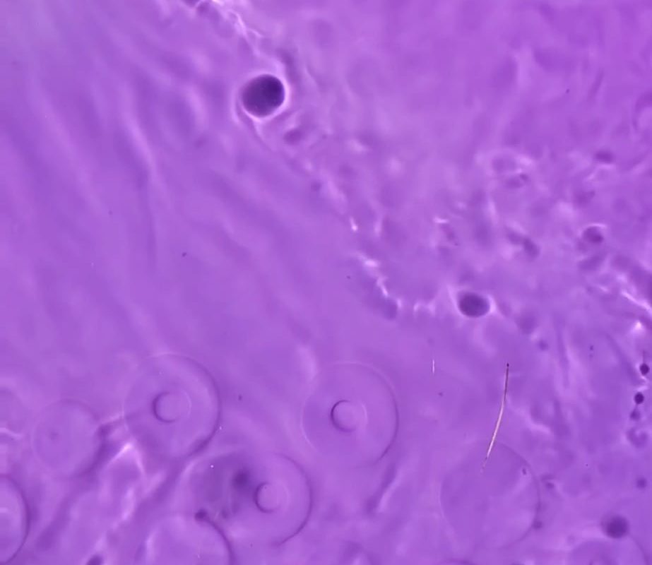 Endless vortex shadows while filling my pool