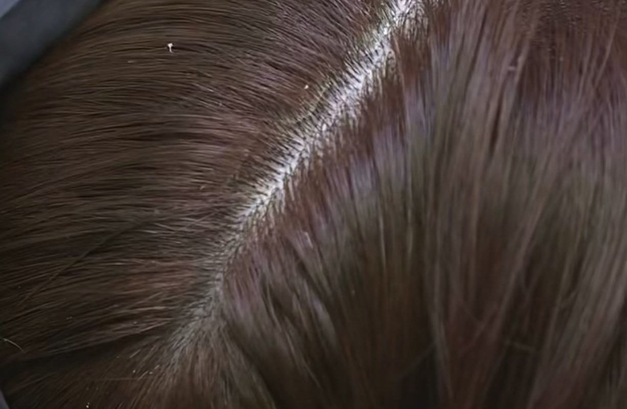 I could watch someone scratch off dandruff all day