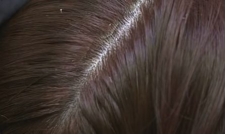 I could watch someone scratch off dandruff all day