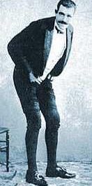 Joseph Pujol (1857-1945), a French entertainer known as Le Pétomane (The Fartist), had such perfect control of his abdominal muscles that he could fart at will, imitating cannon fire and musical instruments, and blowing out a candle from several yards away... and that was his career.