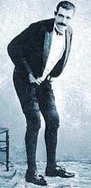 Joseph Pujol (1857-1945), a French entertainer known as Le Pétomane (The Fartist), had such perfect control of his abdominal muscles that he could fart at will, imitating cannon fire and musical instruments, and blowing out a candle from several yards away... and that was his career.