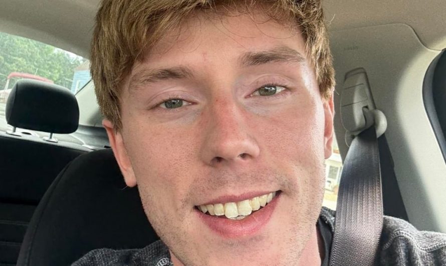 Told I should post this here! I have a diffuse alopecia variant. This is a custom full cap wig! Daily wear, swim/workout/very active with no issue.