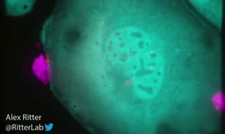 Watch a killer T cell of the immune system destroying a monstrous ovarian cancer cell. [Alex Ritter]