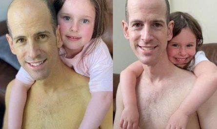 A dad who underwent a liver transplant has shared before and after photos of himself taken just six weeks apart to show the incredible impact of organ donation