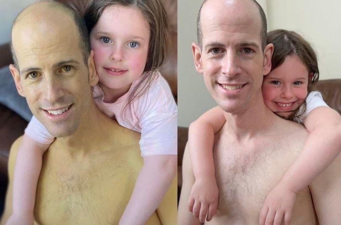 A dad who underwent a liver transplant has shared before and after photos of himself taken just six weeks apart to show the incredible impact of organ donation