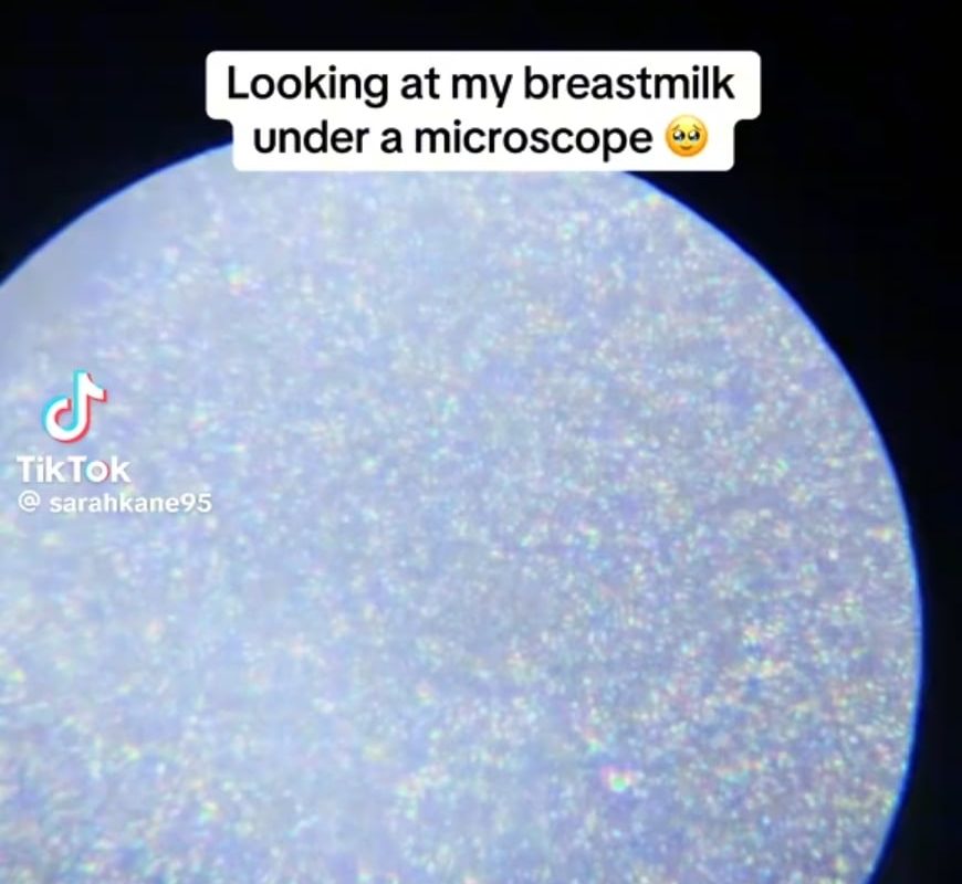 Breastmilk under a microscope 💎💎