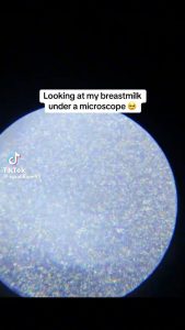 Breastmilk under a microscope is mesmerizing