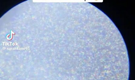 Breastmilk under a microscope is mesmerizing