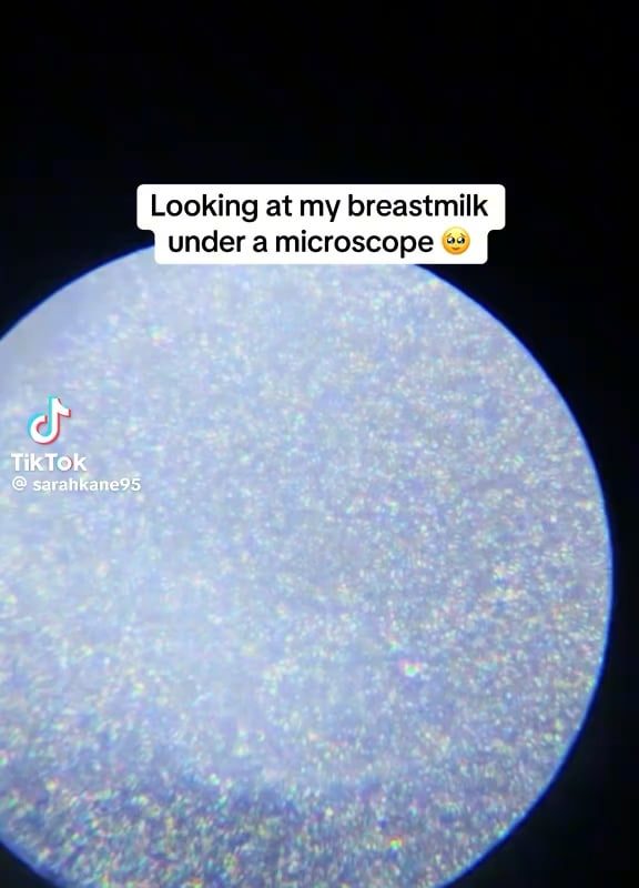 Breastmilk under a microscope is mesmerizing