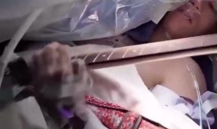 During an awake surgery, guitarist Christian Nolen played Deftones while surgeons removed his brain tumour.