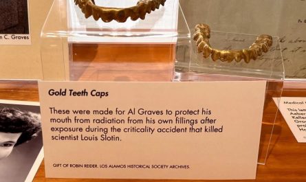 Gold teeth caps were made to save physicist Alvin Graves from radioactive exposure from his own teeth after he was accidentally irradiated in a nuclear chain reaction during an infamous "Tickling the Dragon's Tail" test in 1946 at Los Alamos, NM