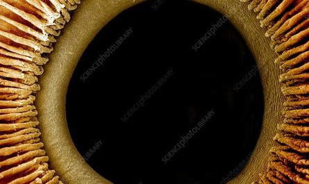 Human eye under a microscope.