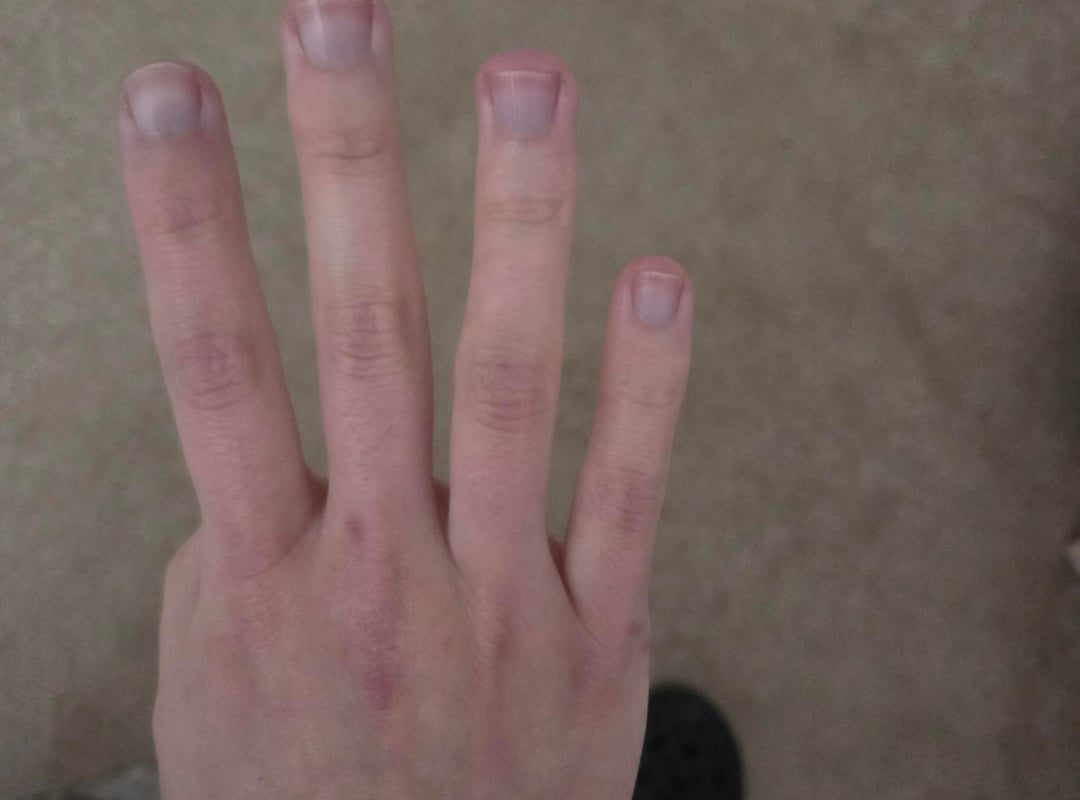 So my finger suddenly turn purple for no reason