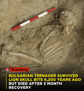 Teenager survived lion bite on the skull. More info in the first comment