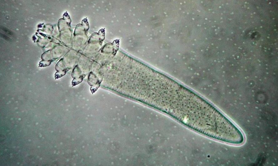 These organisms(Demodex Mites) live on every human face.