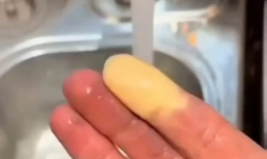 This is how hot water brings blood flow to Raynaud’s fingers, a condition where blood vessels narrow due to cold or stress.