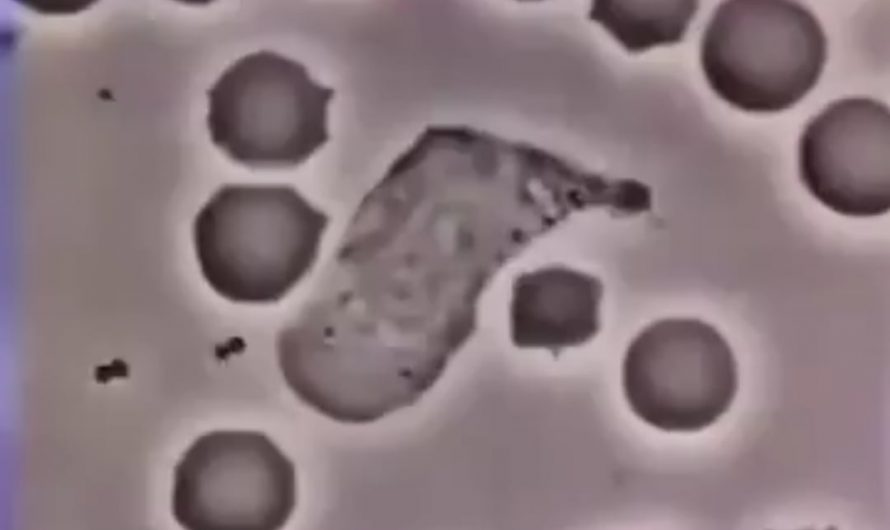 WBC chasing a foreign antigen around under a microscope