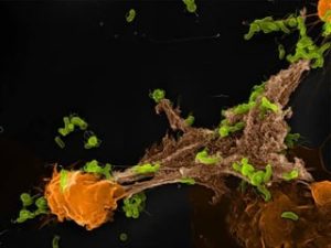 White blood cells using their DNA to capture bacteria. Photos captured using electron microscope and regular microscope