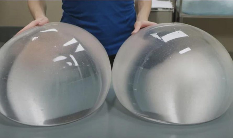 4000cc breast implants