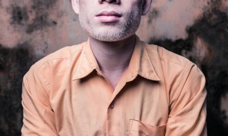 Albinos in India