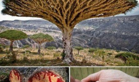The "dragon's blood" tree, it bleeds like humans when cut. Ancient people believed its red, thick sap was dragon's blood. it also has healing & therapuetic qualities. It acts as a natural coagulant to stop bleeding and forms a protective "second skin" over cuts.