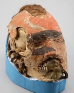 The funeral mask overlaying the face & skull of a warrior who lived 1700 years ago. He belonged to the Tashtyk culture and died after sustaining serious combat injuries.