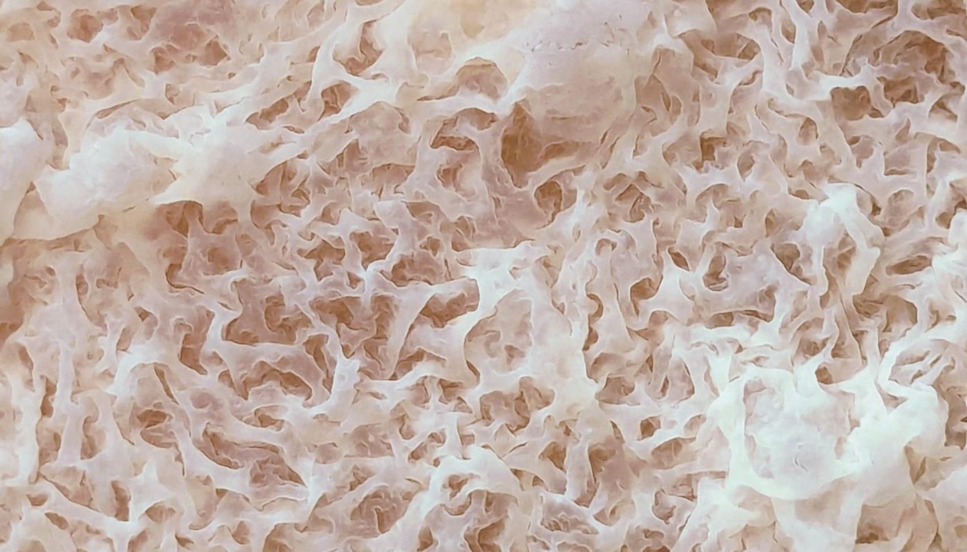 The pattern of this Kahm yeast growing on top of a jar with fermented carrots