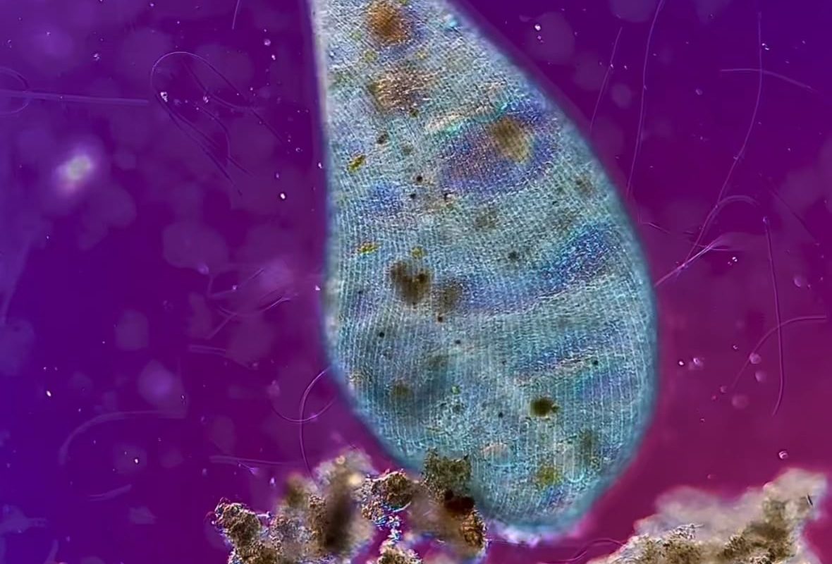 This single-celled protozoan passing by another one under a microscope