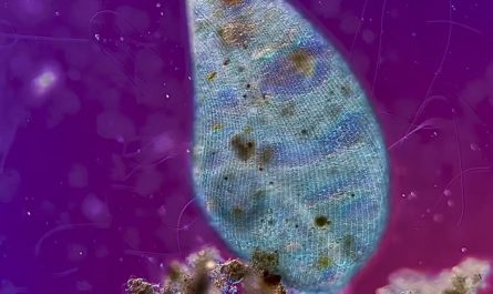 This single-celled protozoan passing by another one under a microscope
