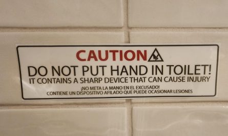 Warning! Don't stick hand in toilet (if u were thinking to do that) public toliet in hospital