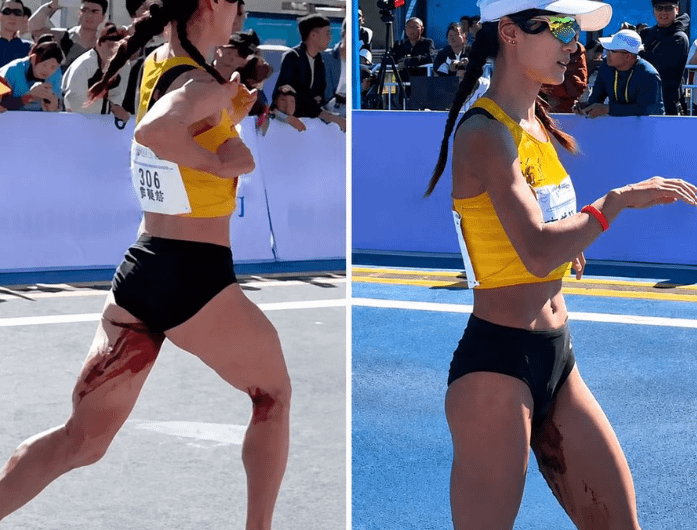 The Chinese marathon runner Li Meizhen kept running despite the visible blood on her legs, as her period started about 8 km from the finish line. Despite this, she refused to drop out and finished it.